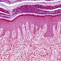 Plantar Skin, Lm Photograph by Alvin Telser Plantar Skin, Lm Photograph by Alvin Telser