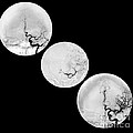 Stroke Treatment Photograph by Medical Body Scans Stroke Treatment Photograph by Medical Body Scans