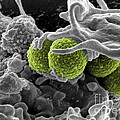 Methicillin-resistant Staphylococcus Photograph by Science Source Methicillin-resistant Staphylococcus Photograph by Science Source