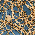 Leptospira Photograph by Science Source Leptospira Photograph by Science Source