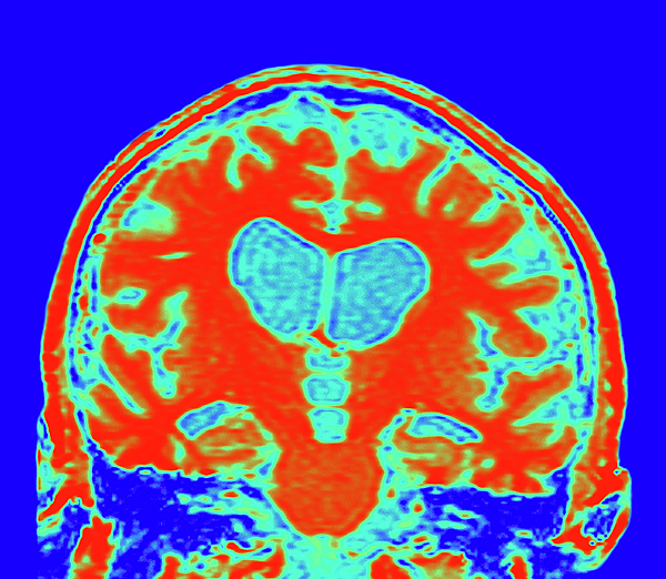 Brain and body survey  Science and Industry Museum