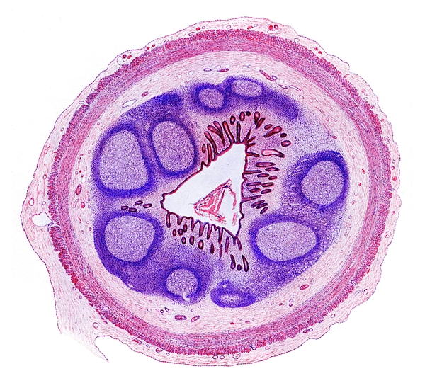 Appendix Histology Greeting Card by Microscape / Science Photo Library
