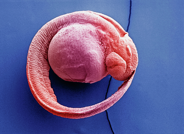Dr Richard Kessel / Science Photo Library - Zebrafish Embryo Sem X100