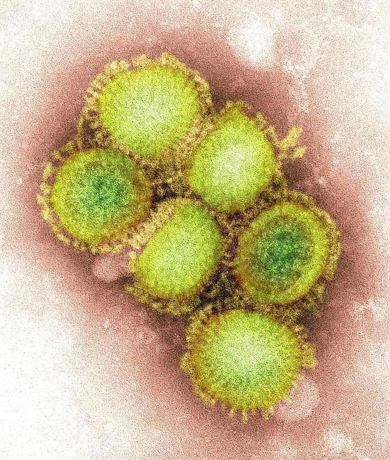 Swine Flu Photograph - 2009 H1n1 Swine Flu Virus, Tem #1 by Cdc