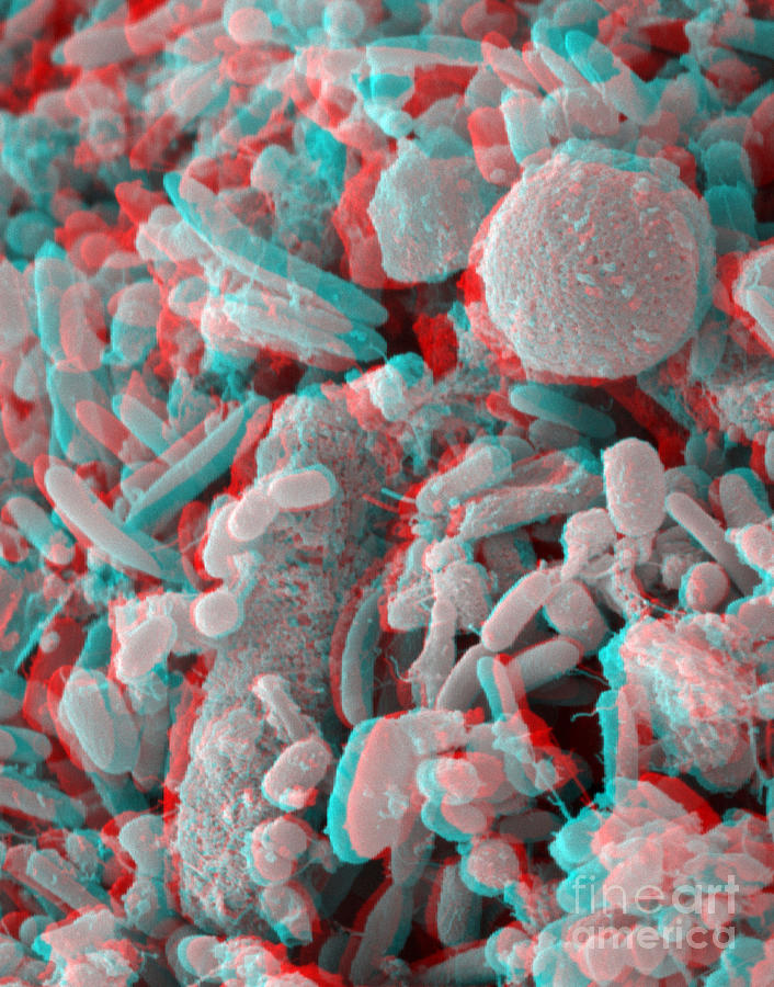 Anaglyph Of Human Feces #1 Photograph by Scimat