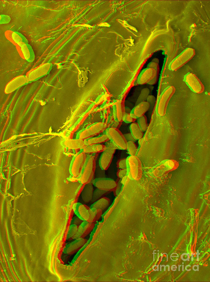Anaglyph Of Infected Lettuce Leaf #1 Photograph by Scimat