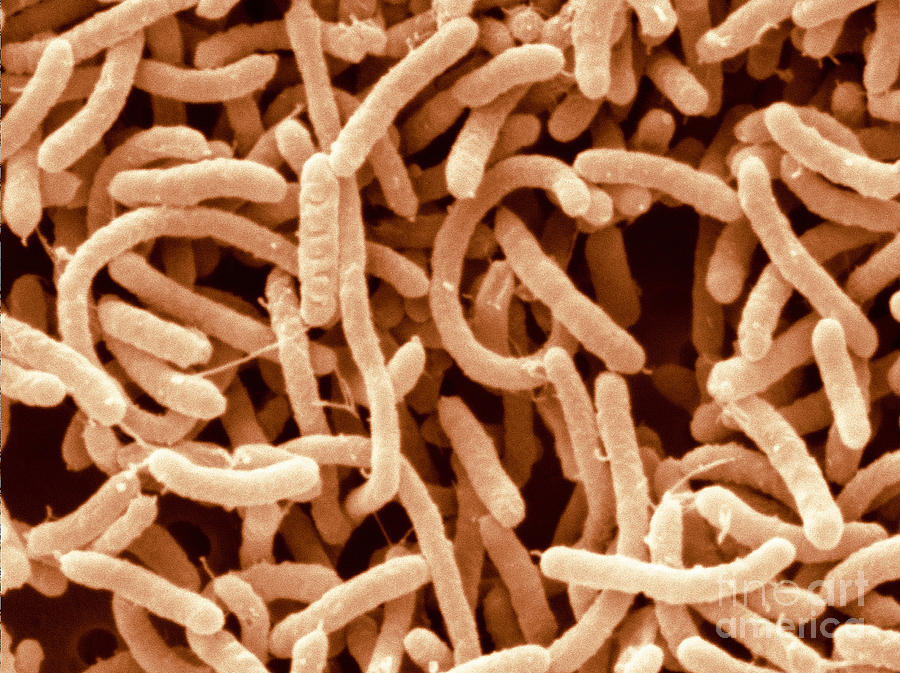 Arcobacter Septicus Bacteria, Sem #1 Photograph by Scimat
