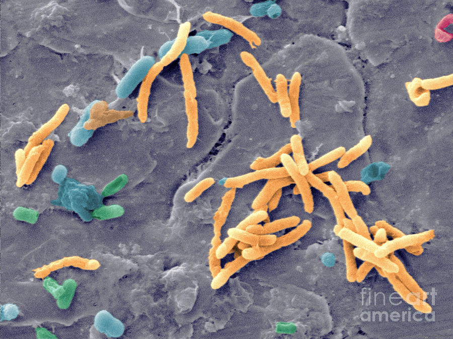 bacteria-from-raw-chicken-meat-sem-photograph-by-scimat-pixels