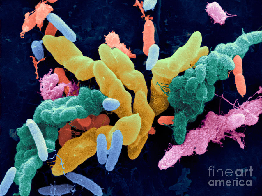 Bacteria In Crow Droppings, Sem #1 Photograph by Scimat