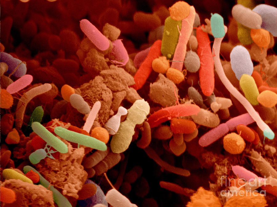 Bacteria In Human Feces, Sem #1 Photograph by Scimat