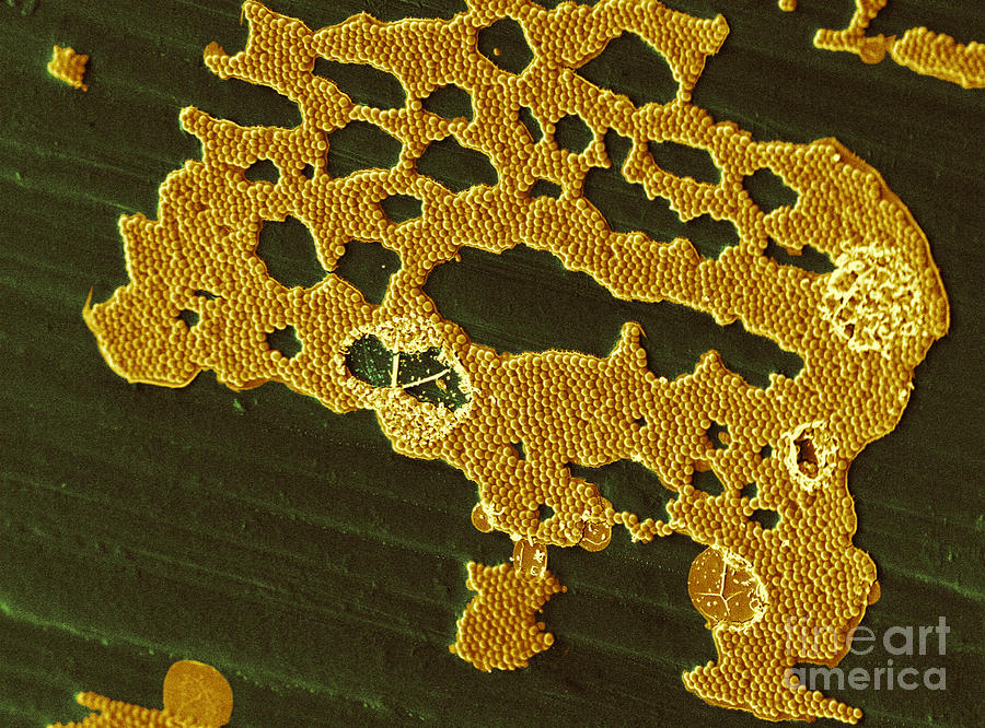 Bacterial Biofilm #1 Photograph by Scimat