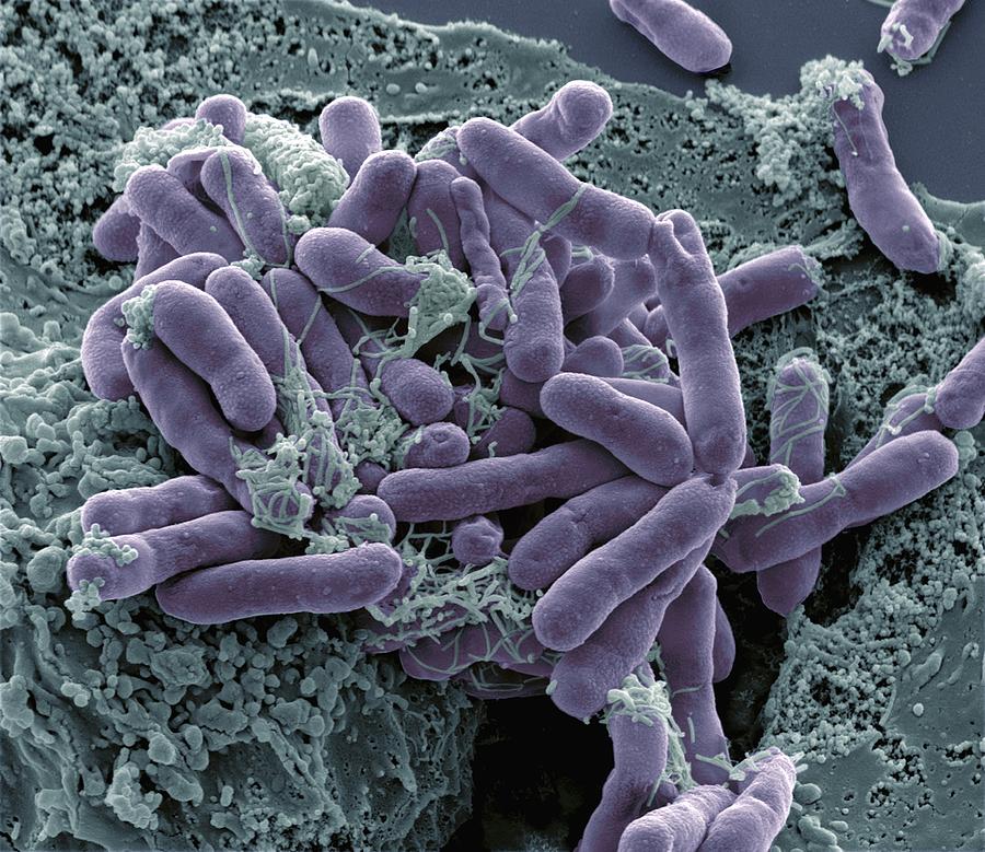 Escherichia Coli Photograph - Bacterial Contamination, Sem #1 by Steve Gschmeissner