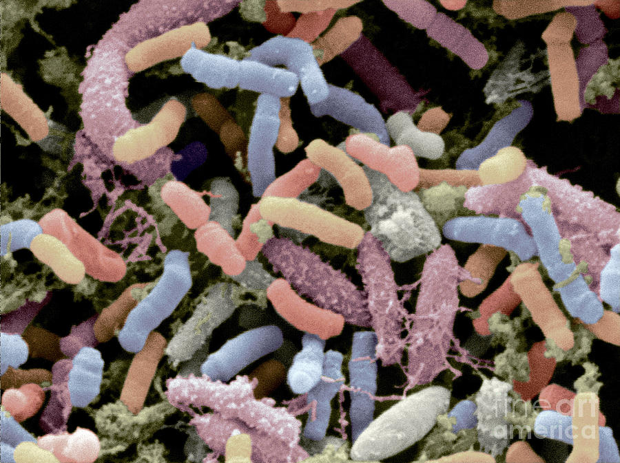 Bacterial Microflora In The Stool #1 Photograph by Scimat