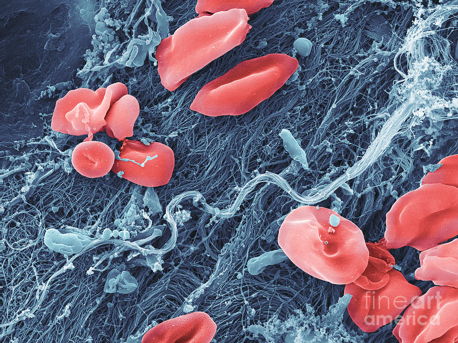 Blood Platelets And Red Blood Cell, Sem #1 Photograph by Ted Kinsman