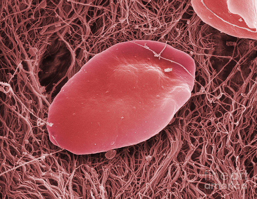 Blood Platelets, Sem #1 Photograph by Ted Kinsman