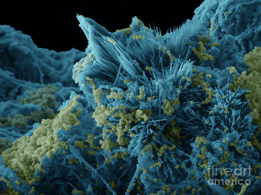 Blue Cheese, Sem #1 Photograph by Ted Kinsman