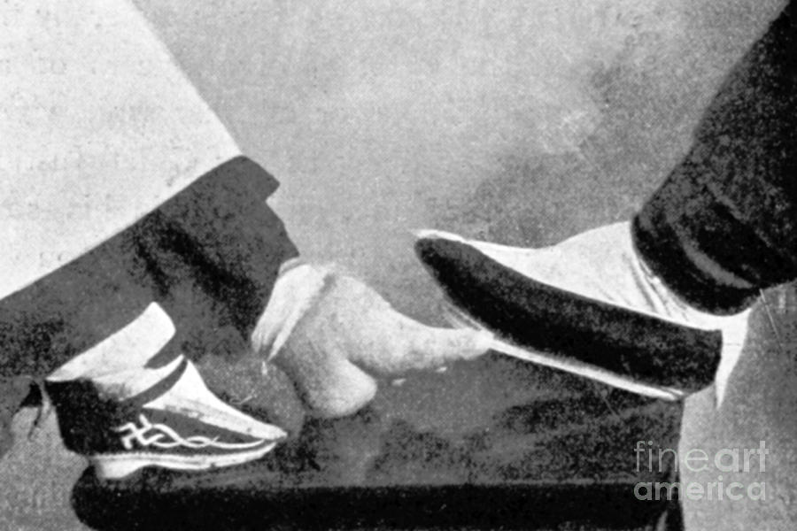 Bound Compared To Normal Foot, China #1 Photograph by British Library