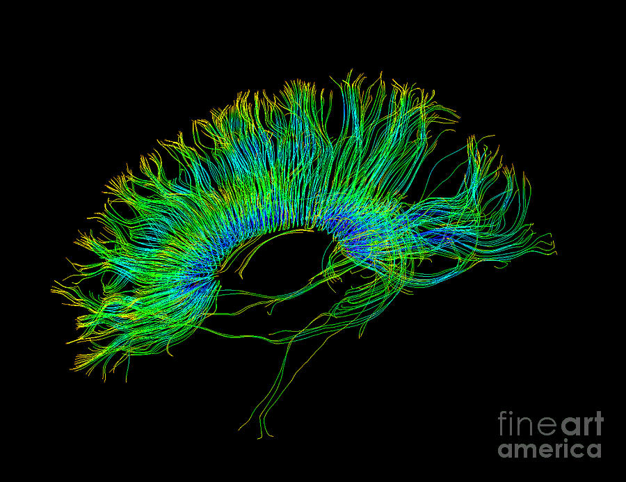 Brain, Fiber Tractography Image #1 Photograph by Scott Camazine