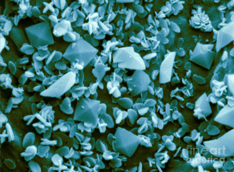 Calcium Oxalate Crystals, Sem #1 Photograph by Scimat
