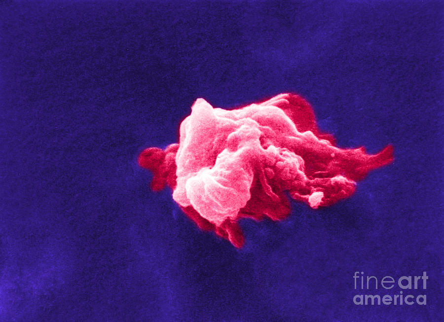 Cancer Cell Death, Sem 6 Of 6 #1 Photograph by Science Source