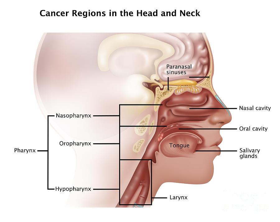 Cancer Regions In Head And Neck #1 Photograph by Gwen Shockey