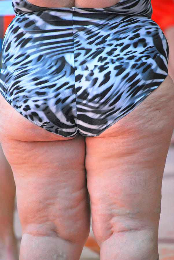 Cellulite body. #1 Photograph by Oscar Williams - Pixels