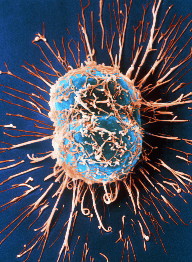Images Photograph - Cervical Cancer Cells Dividing #1 by Steve Gschmeissner