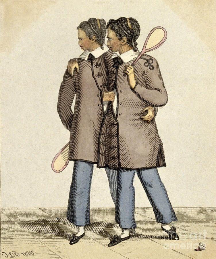 Science Photograph - Chang And Eng, Siamese Twins #1 by Wellcome Images