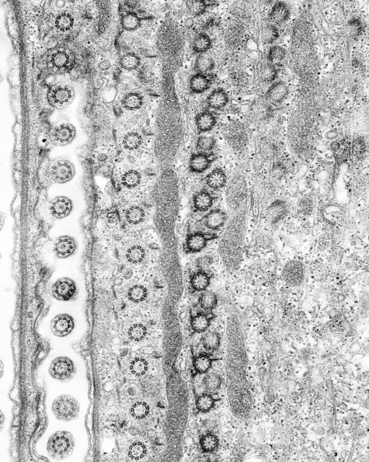 Cilia and Basal Bodies TEM #1 Photograph by Greg Antipa - Pixels