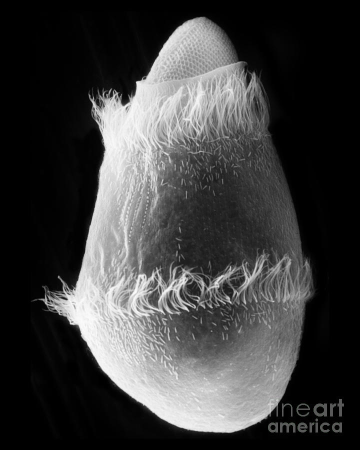 Didinium Ingesting Paramecium, Sem #1 Photograph by Greg Antipa
