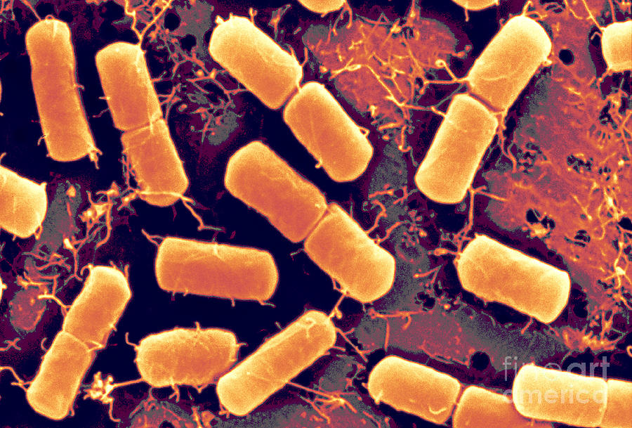 Dividing Bacteria #1 Photograph by Scimat