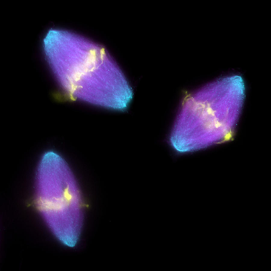 Metaphase Photograph - Dividing Cells #1 by Dr Torsten Wittmann