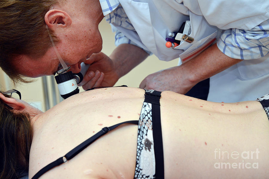 Doctor Examines Patients Moles #1 Photograph by Frdrik Astier