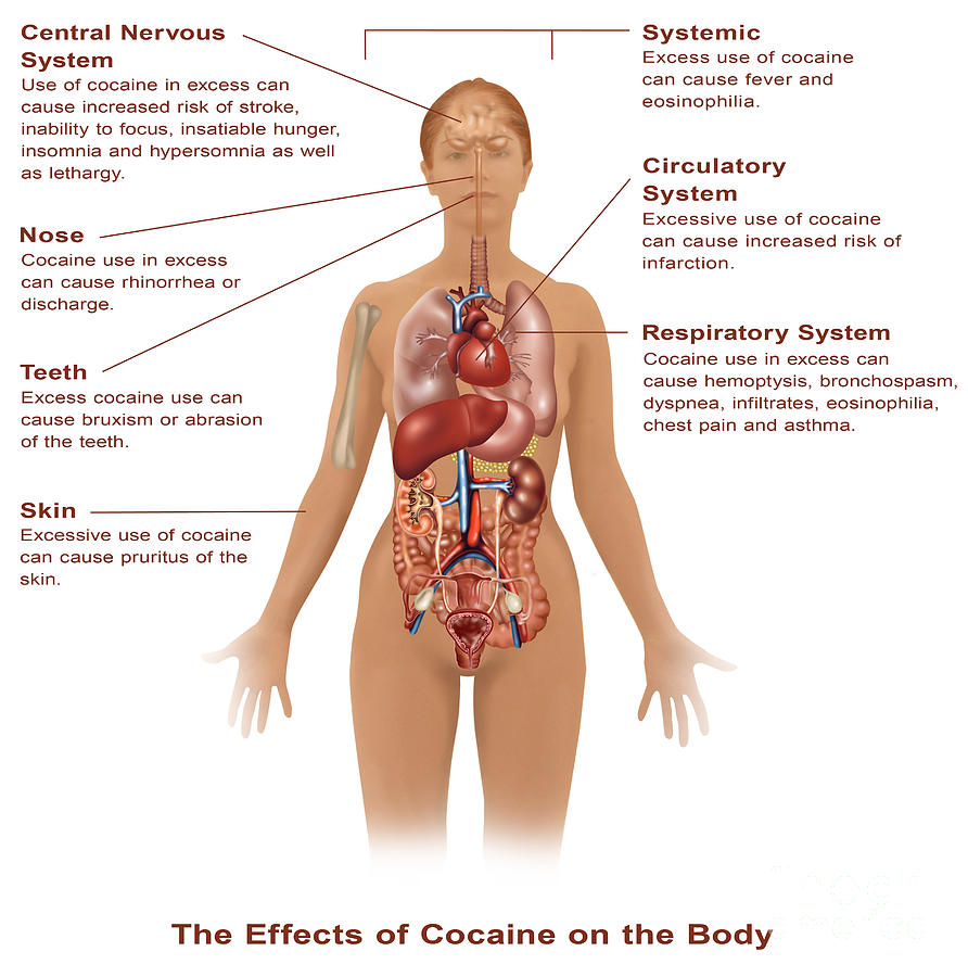 Effects Of Cocaine Use #1 Photograph by Gwen Shockey