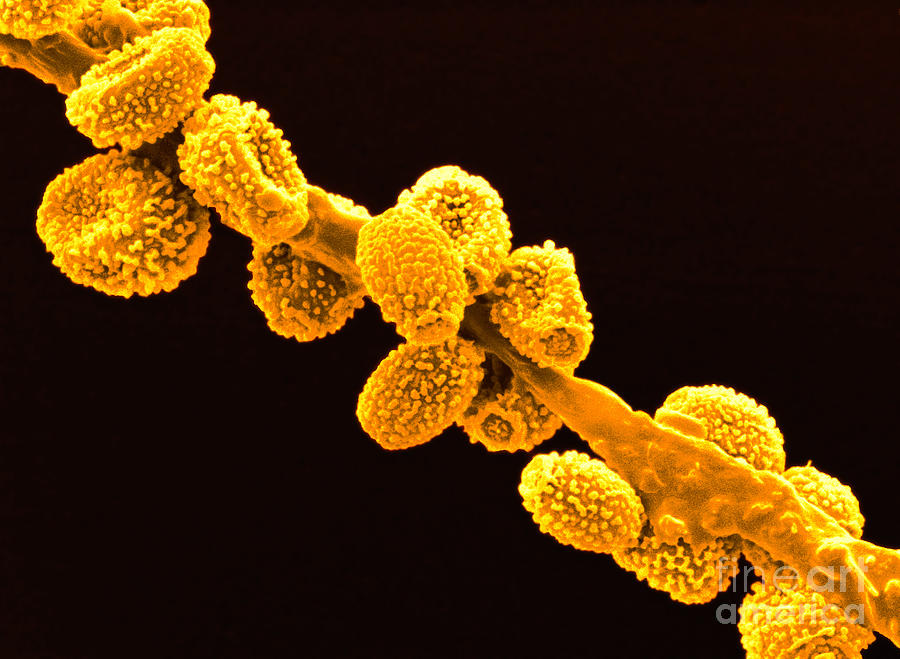 Eurotium Spores #1 Photograph by Scimat