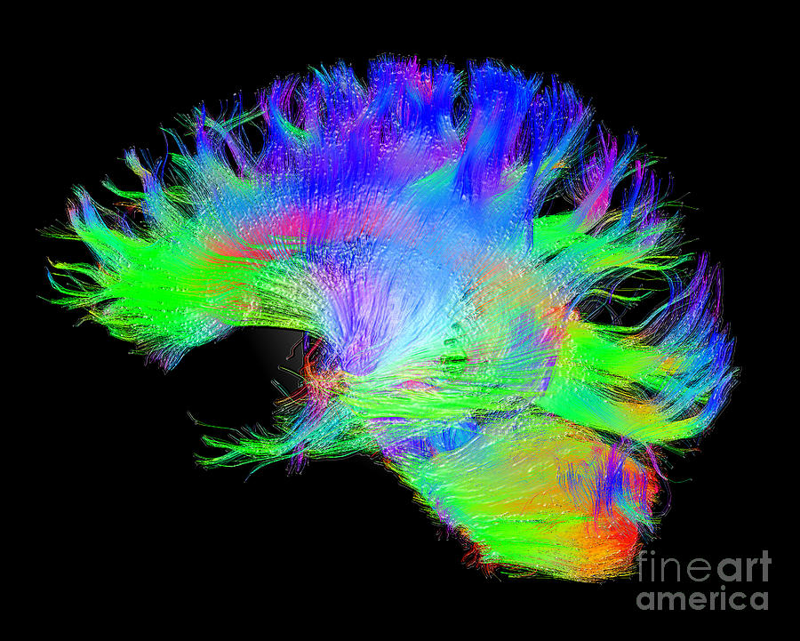 Fiber Tracts Of The Brain, Dti #1 Photograph by Living Art Enterprises
