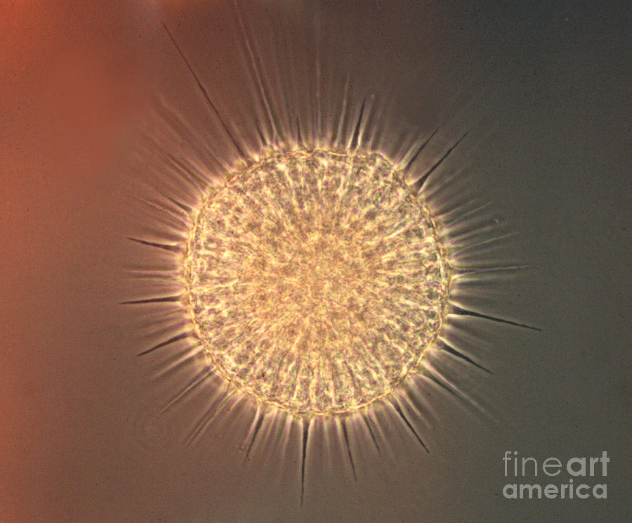 Freshwater Amoeba Actinosphaerium LM #1 Photograph by Greg Antipa