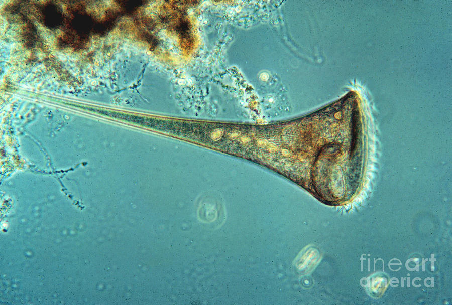 Freshwater Ciliate Stentor LM #1 Photograph by Greg Antipa