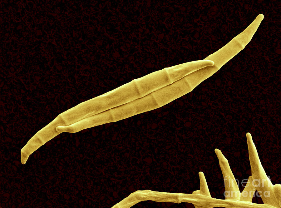 Fusarium Graminearum Spores #1 Photograph by Scimat