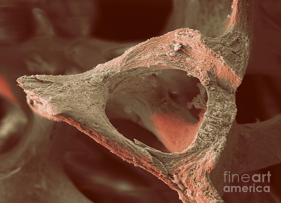 Human Bone, Sem #1 Photograph by Ted Kinsman