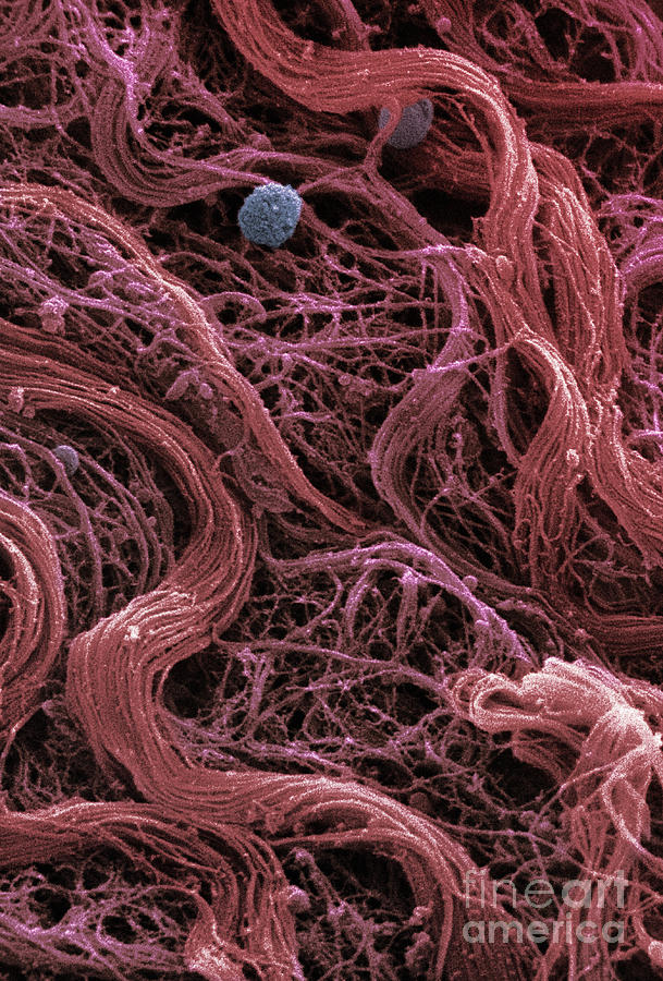 Human Muscle Tissue, Sem #1 Photograph by Ted Kinsman