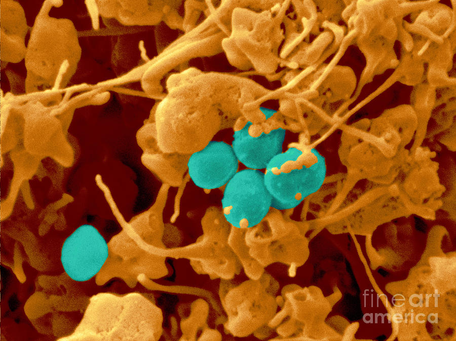Human Platelets & Staphylococcus, Sem #1 Photograph by Scimat