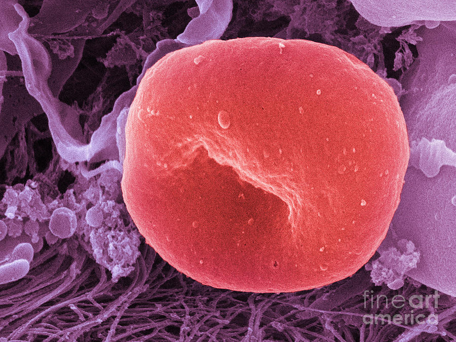 Human Red Blood Cell, Sem #1 Photograph by Ted Kinsman