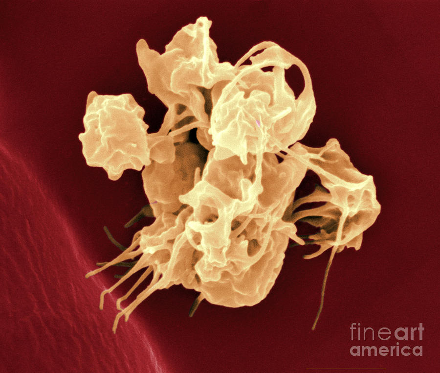 Human Thrombocytes Platelets, Sem #1 Photograph by Scimat