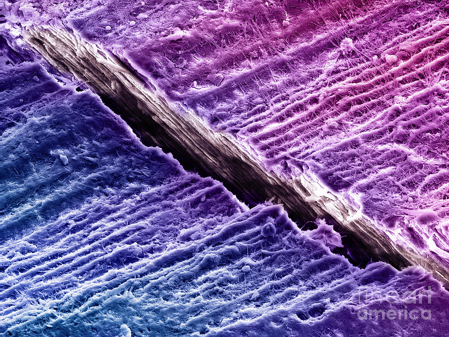 Human Tooth Dentine, Sem #4 Photograph by Ted Kinsman
