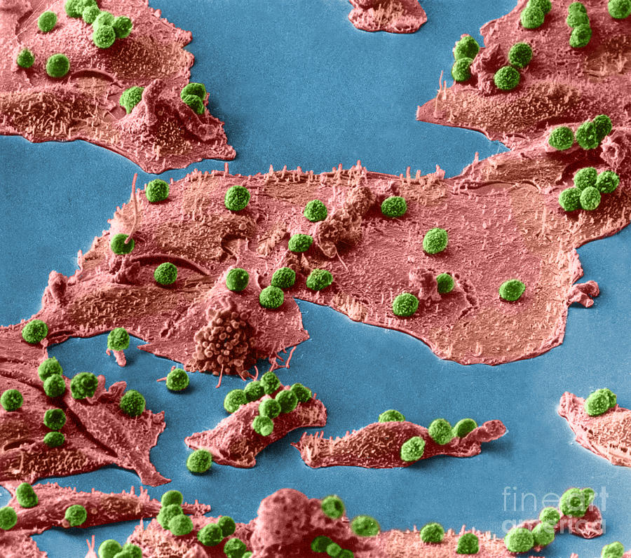 Immune Cells Attacking Cancer Cells, Sem #1 Photograph by Science Source