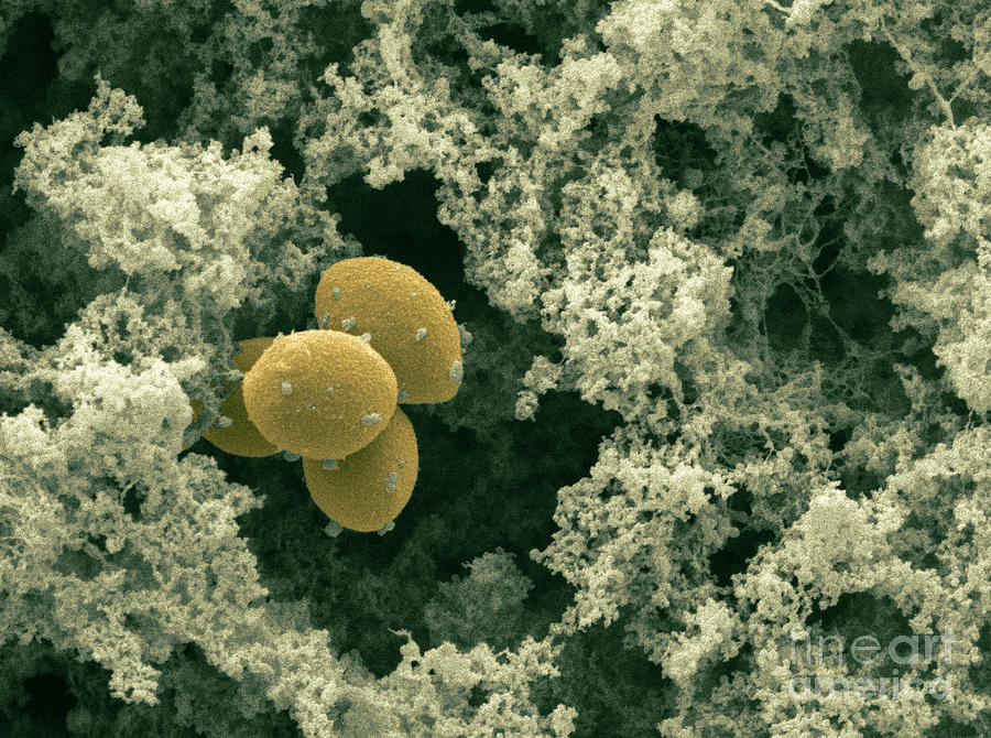 Плесень аллерген. Класс сахаромицеты. Saccharomyces ellipsoideus. Candida kefir под микроскопом.