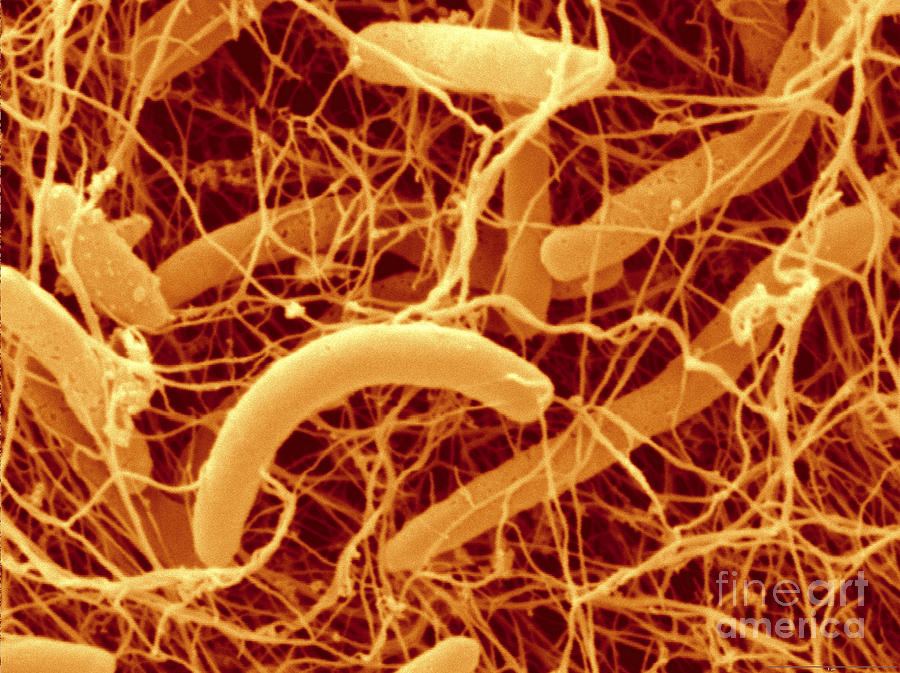 Kombucha Bacteria, Sem #1 Photograph by Scimat
