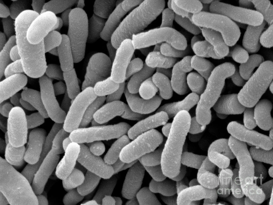 Lactobacillus Acidophilus And L. Casei Photograph by Scimat - Pixels