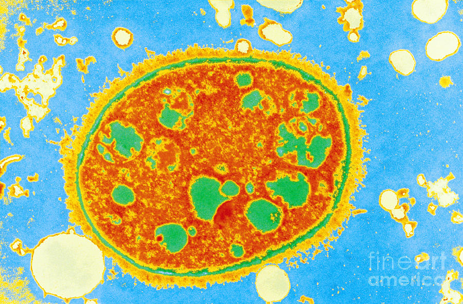 Lactobacillus #1 Photograph by Scimat